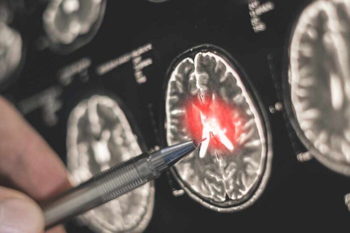 shutterstock_2718496241.jpg A hand pointing at a brain scan with highlighted areas