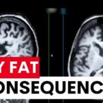 Study reveals belly fat linked to increased dementia risk | 7NEWS