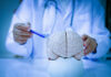Brain Aging Isn’t Gradual — Here’s the Best Window To Act A doctor pointing at a brain model with a pen
