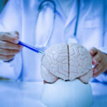 Brain Aging Isn’t Gradual — Here’s the Best Window To Act A doctor pointing at a brain model with a pen