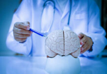 Brain Aging Isn’t Gradual — Here’s the Best Window To Act A doctor pointing at a brain model with a pen