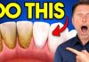 Teeth Whitening Two-Ingredient DIY Hack The #1 BEST Remedy for Dental Plaque (TARTAR)