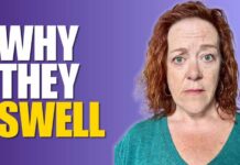 7 Reasons Your Feet, Ankles, or Legs Are Swelling From A Nurse