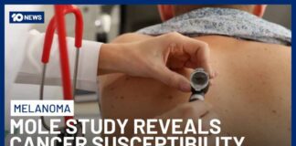 Aussie Scientists Work To Unravel Melanoma Mysteries Through World’s Largest Genetic Study | 10 News