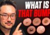Common Skin Growths Explained Lumps and Bumps On Your Skin | Dr. Danny Guo