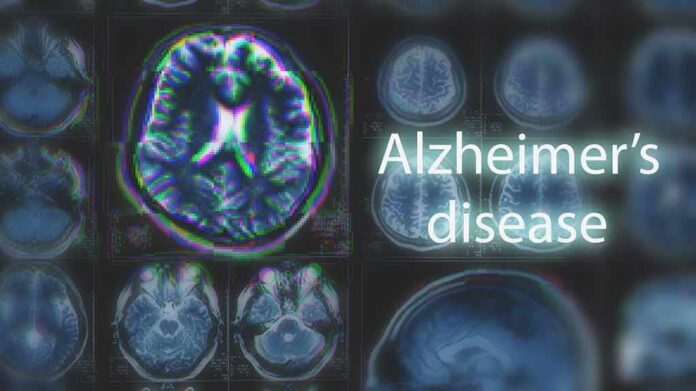 shutterstock_1054068035-1 Brain MRI scans with highlighted section and text overlay