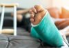 Low D, High Surgery Pain: Surgeons Stunned Injured foot in a turquoise cast resting on a couch