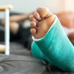 Injured foot in a turquoise cast resting on a couch