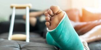 Injured foot in a turquoise cast resting on a couch