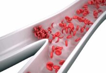 Red blood cells in a narrowed blood vessel